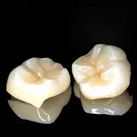 Coroas e Onlays de Porcelana