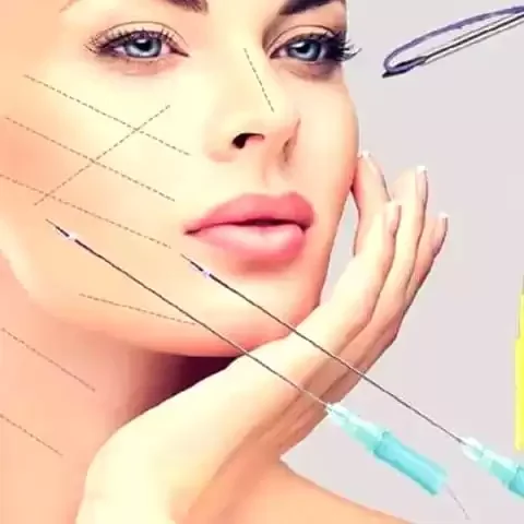 Lifting Facial com Fios de PDO