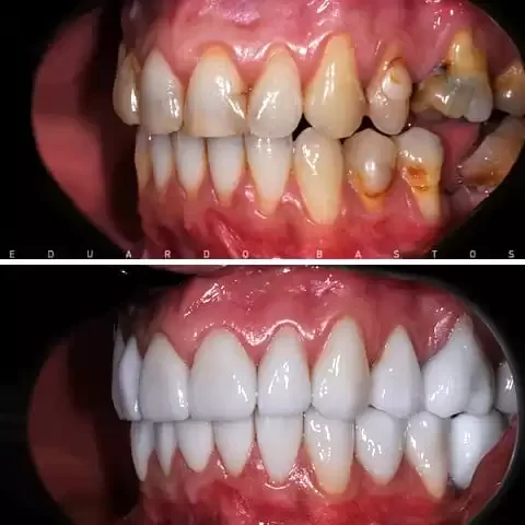 Reabilitação Oral